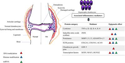 Interplay of Inflammatory Mediators with Epigenetics and Cartilage Modifications in Osteoarthritis